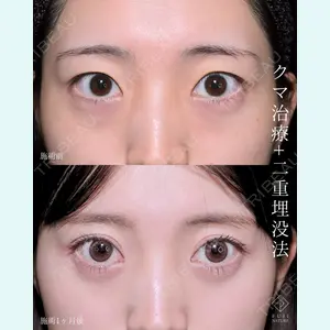 症例