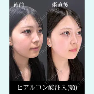 症例