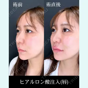 症例