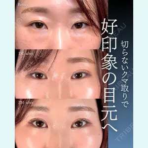 症例