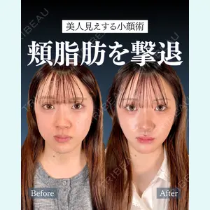 症例