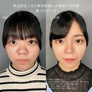 症例