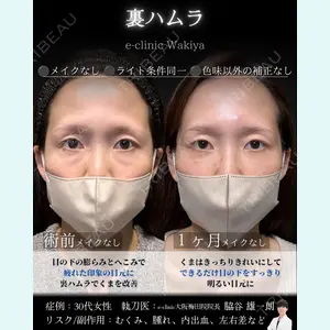 症例