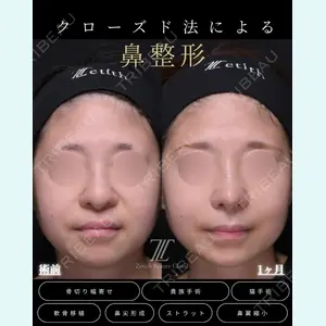 症例