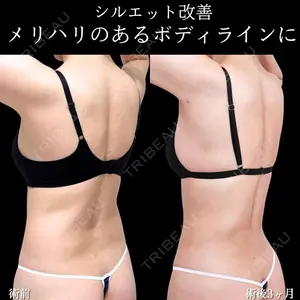 症例