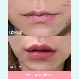症例