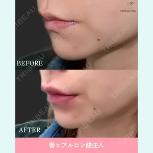 症例