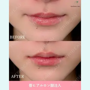 症例