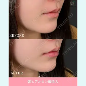 症例