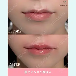 症例