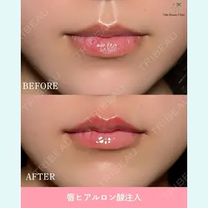 症例