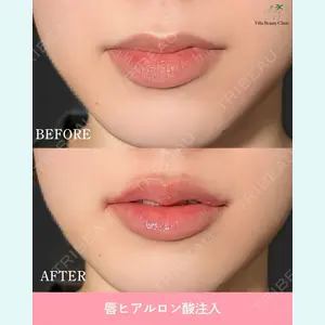 症例