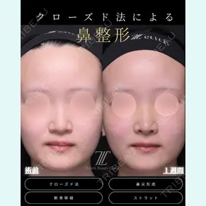 症例