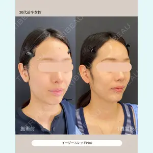 症例