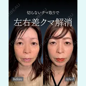 症例