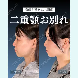 症例