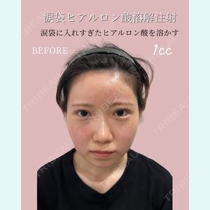 症例