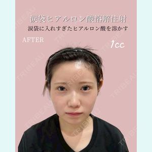 症例
