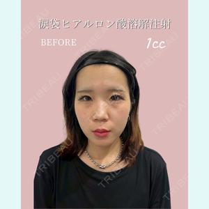 症例