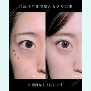 症例