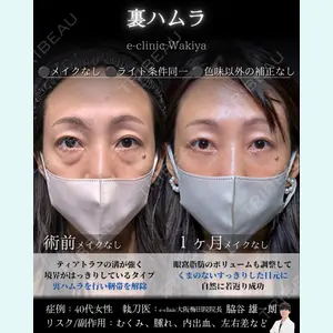 症例