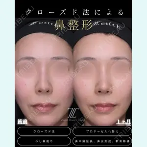 症例