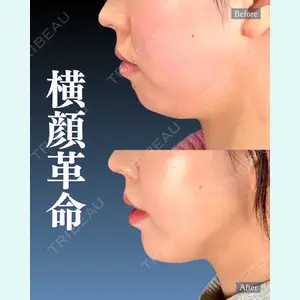 症例