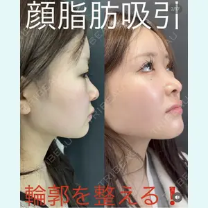 症例