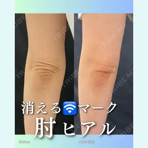 症例