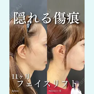 症例