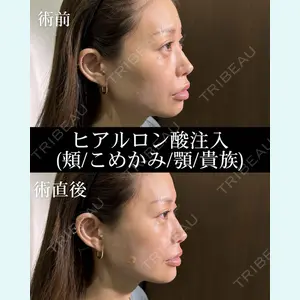 症例