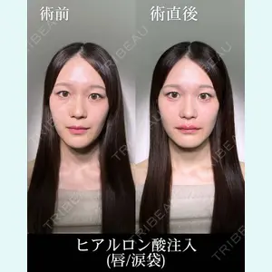 症例