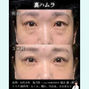 症例