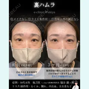 症例