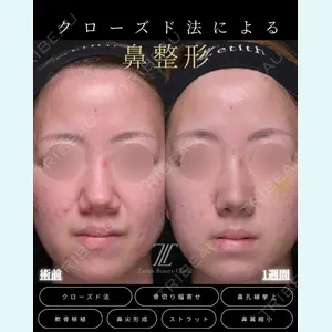 症例