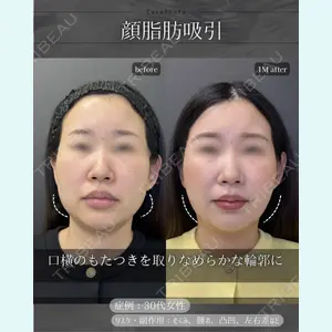 症例