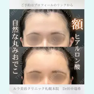 症例