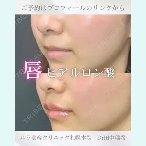 症例