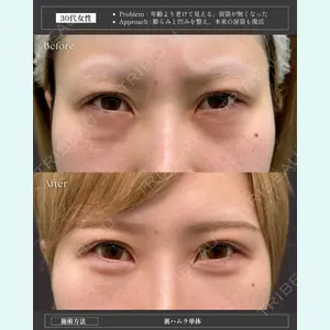 症例
