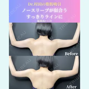 症例