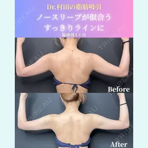 症例