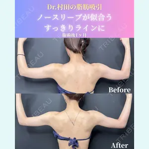 症例