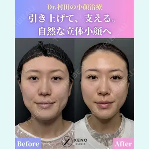 症例