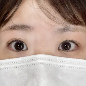 症例