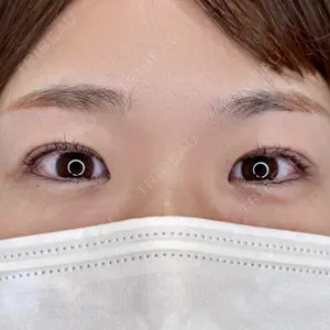 症例