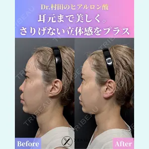 症例