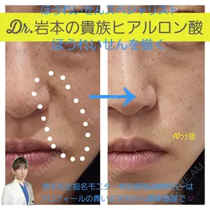 症例