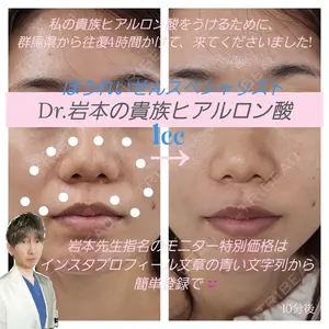 症例