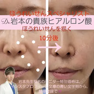 症例