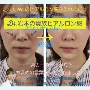 症例